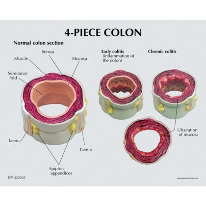 Colon con Patologías 4 piezas - Imagen 3