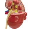 Riñon con Patología - Imagen 2