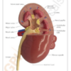 Riñon con Patología - Imagen 4