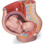 MEDart™ Pelvis durante el embarazo