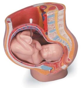 MEDart™ Pelvis durante el embarazo