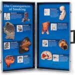 Las consecuencias de fumar – Display tridimensional