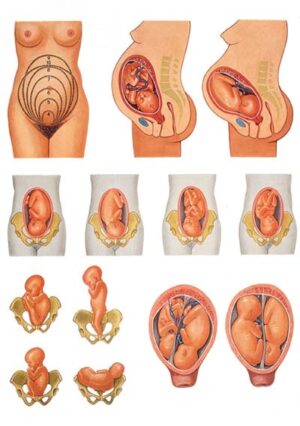 Posición del Bebé antes del Parto