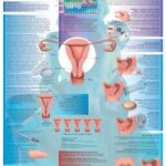 Contraception