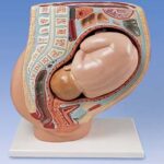 Pelvis de embarazo, 2 piezas