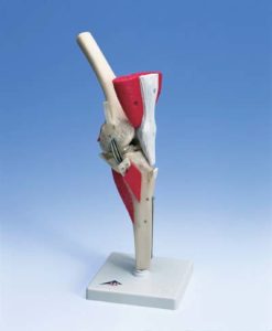 Rodilla de lujo