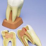 Molar superior de tres raíces, 2 piezas