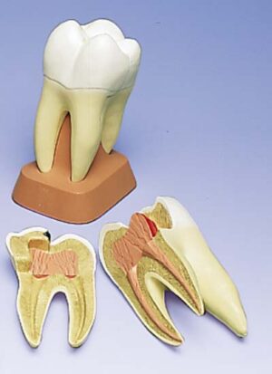 Molar superior de tres raíces, 2 piezas