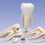 Molar superior, 6 piezas
