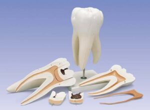 Molar superior, 6 piezas