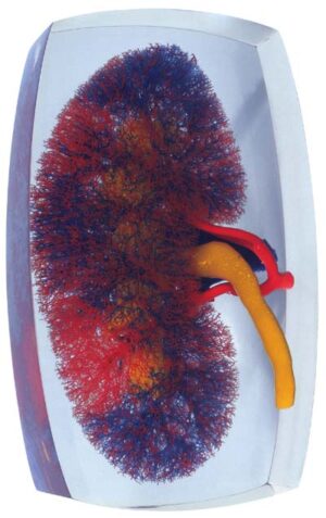 Modelo de vasos renales (rojo-amarillo-azul)