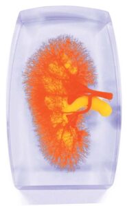 Modelo de los vasos renales (rojo-amarillo)