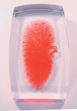 Modelo de los vasos renales (rojo)