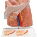 Modelo de hernia inguinal