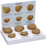 Prostata