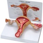 Utero con Patologías