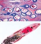 Parasitología General. Colección Grande - español