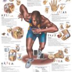 Lesiones Deportivas