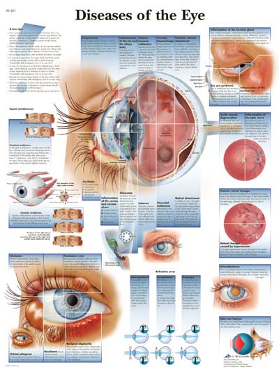 Enfermedades del Ojo