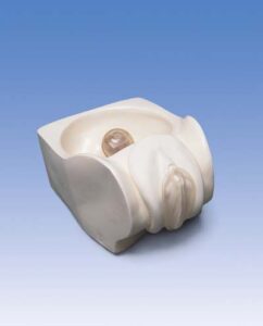 Modelo de Anticonceptivo Femenino