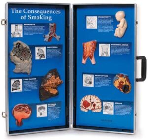 Las consecuencias de fumar – Display tridimensional
