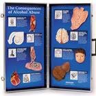 Las consecuencias del abuso del alcohol – Display tridimensional
