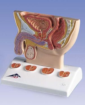 Modelo de la próstata