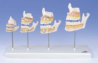 Desarrollo de la dentadura