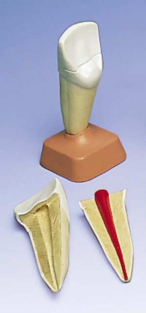 Incisivo superior, 2 piezas