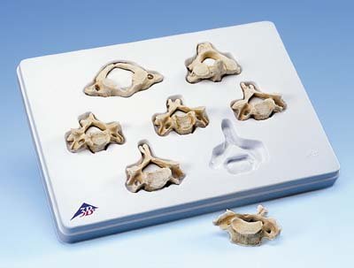 Equipo con 7 BONElike™ vértebras cervicales Equipo con 7 BONElike™ vértebras cervicales