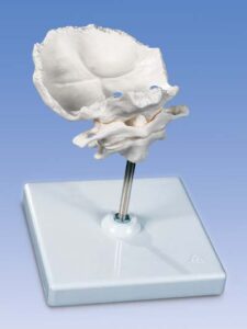 Atlas y axis con lamina horizontal del occipital Montado sobre s
