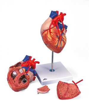 Corazón con bypass