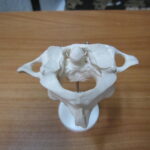 Atlas y Axis