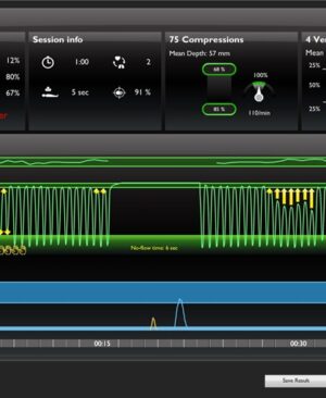 SkillReporter™ (PC) Informador de habilidades inalámbrico para Resusci Anne