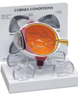 Sección transversal de ojo con córnea