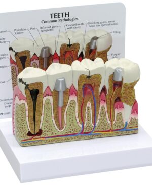 Modelo de dientes