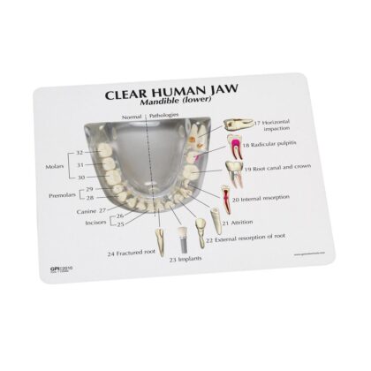 Modelo de mandíbula humana transparente con (dientes) - Imagen 3