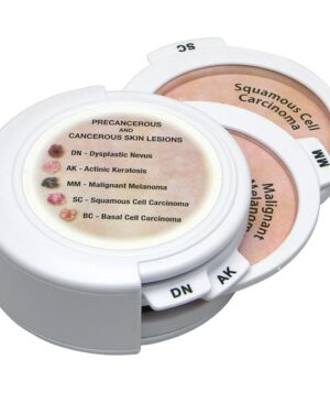 Conjunto de discos de cáncer de piel
