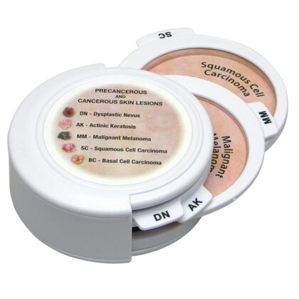 Conjunto de discos de cáncer de piel