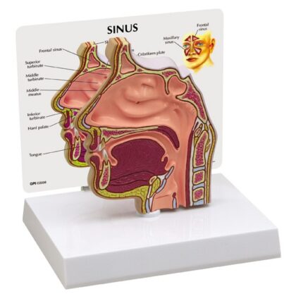 Sección transversal del seno nasal sinus - Imagen 2