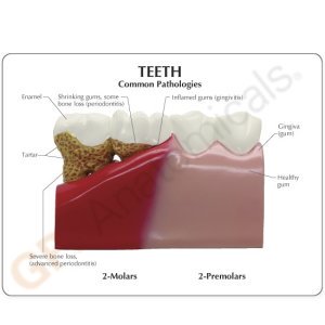 teeth-model-4