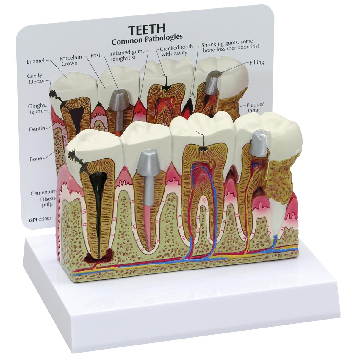 1019539_02_1200_1200_Modelo-de-dientes