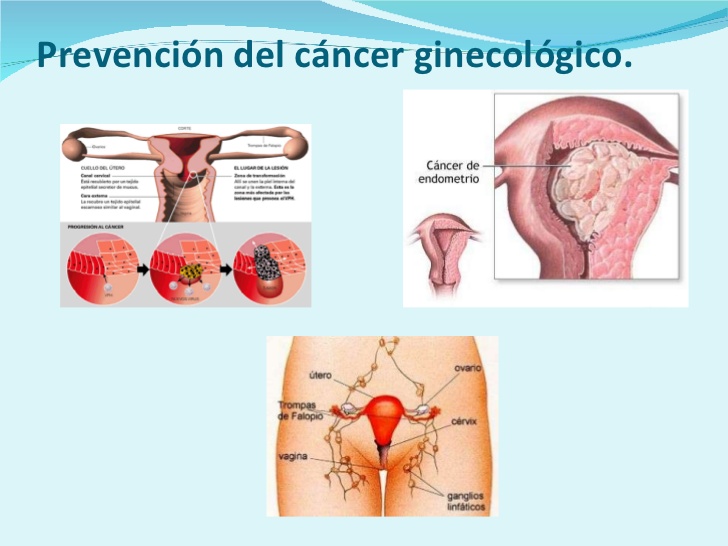 Ginecologicos