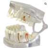 Modelo de mandíbula humana transparente con (dientes) - Imagen 4