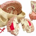 Modelo de cerebro