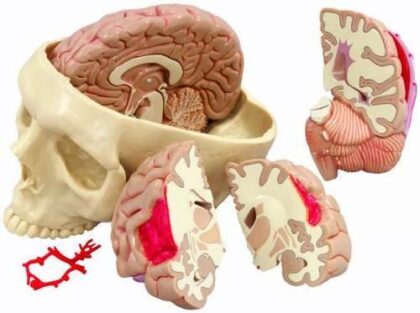Modelo de cerebro
