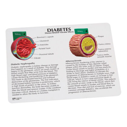 Modelo de diabetes de 4 piezas - Imagen 3