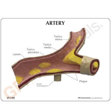 Modelo de arteria - Imagen 2