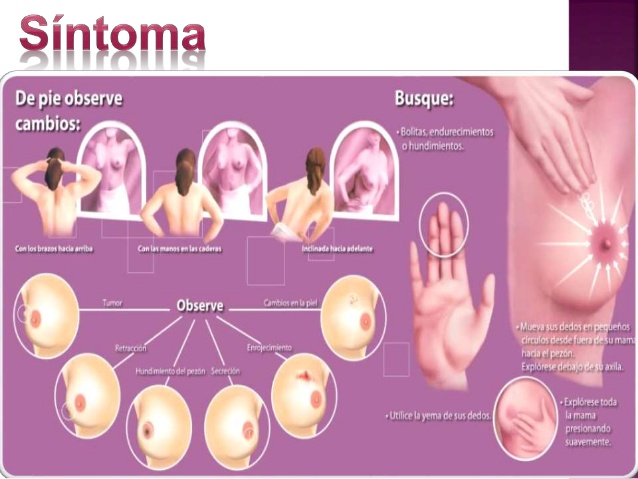 Examen de mama