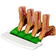 Enfermedad por reflujo gastroesofágico (GERD), 4 piezas